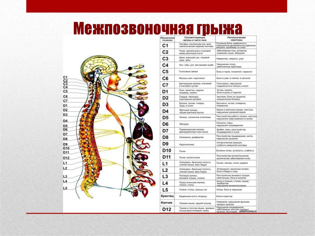 Связь позвоночника. Позвоночник и внутренние органы взаимосвязь. Связь позвонков с внутренними органами. Влияние позвоночника на внутренние органы схема. Название позвоночных грыж.