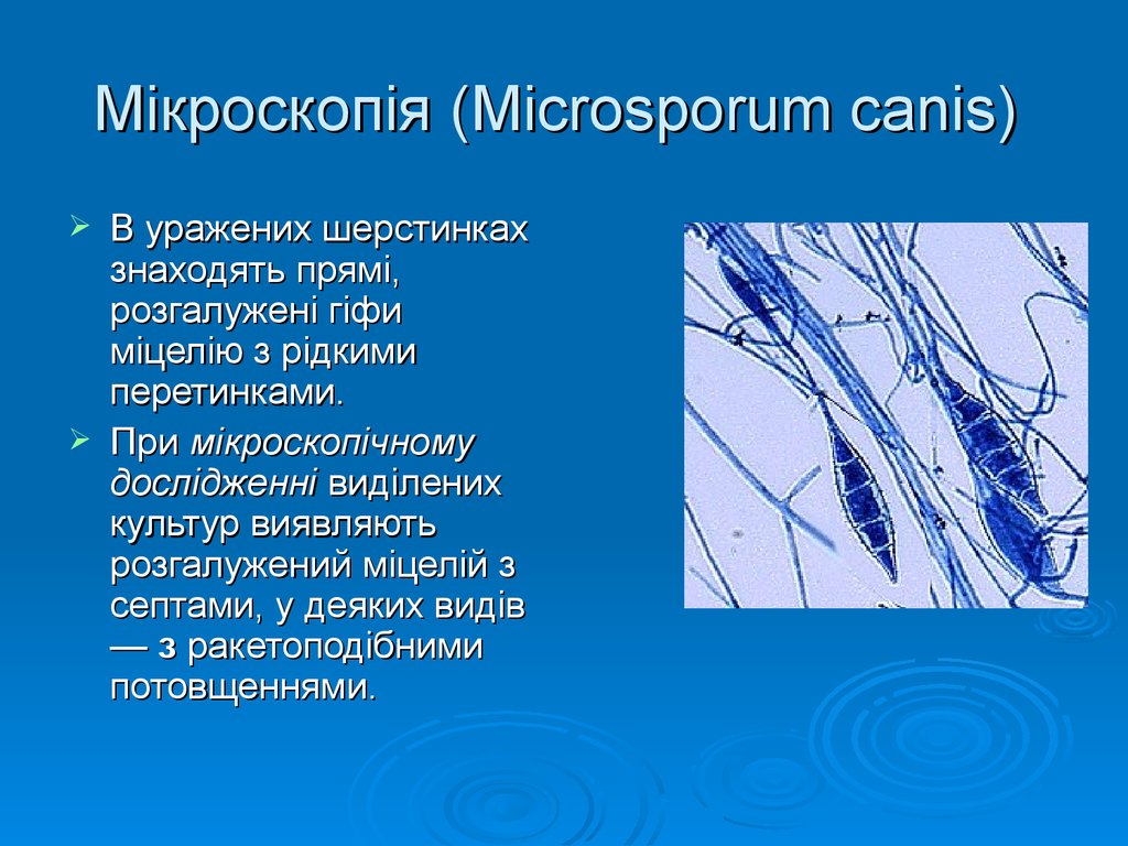 Мікроскопія (Microsporum canis)