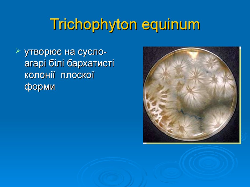 Trichophyton equinum