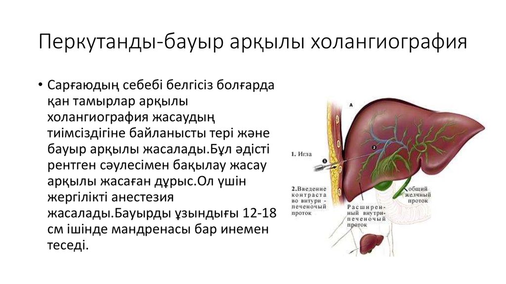 Бауыр циррозы презентация