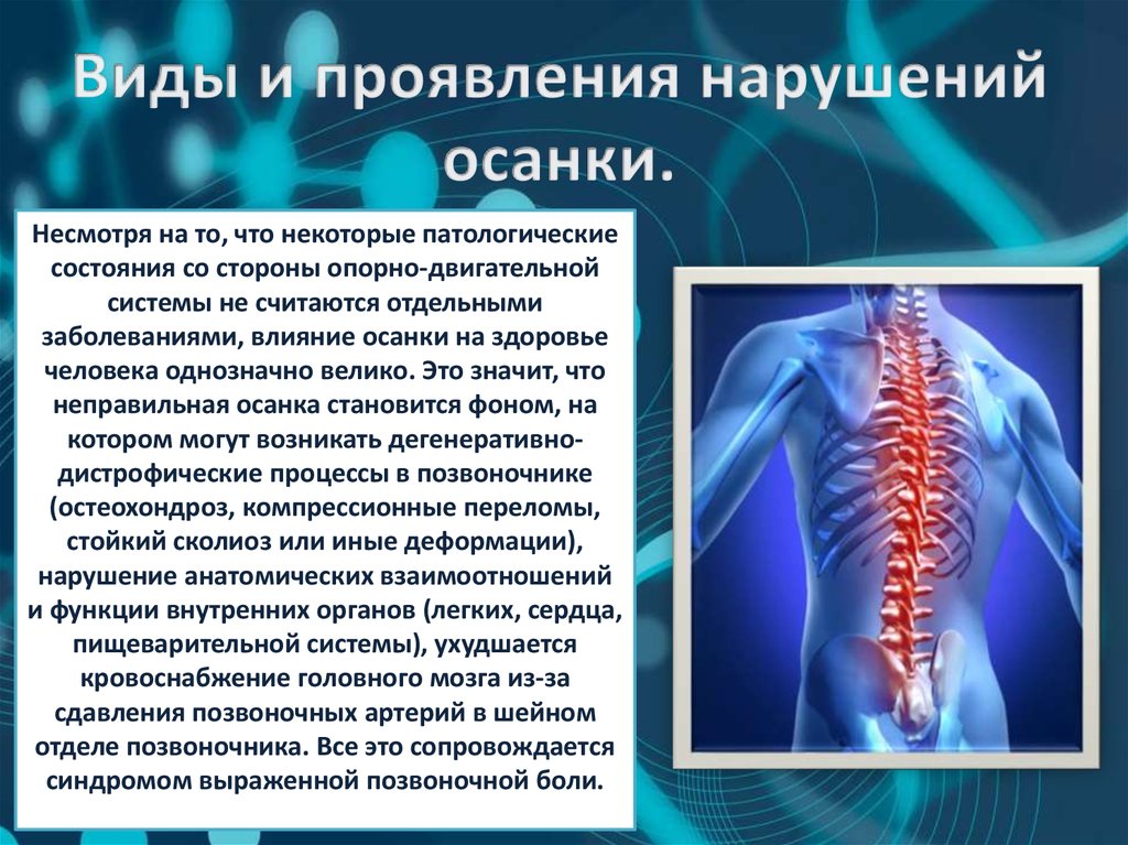 Виды и проявления нарушений осанки.