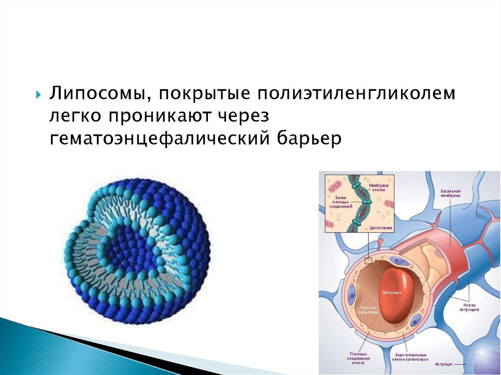 Перенос мозгов калина 1