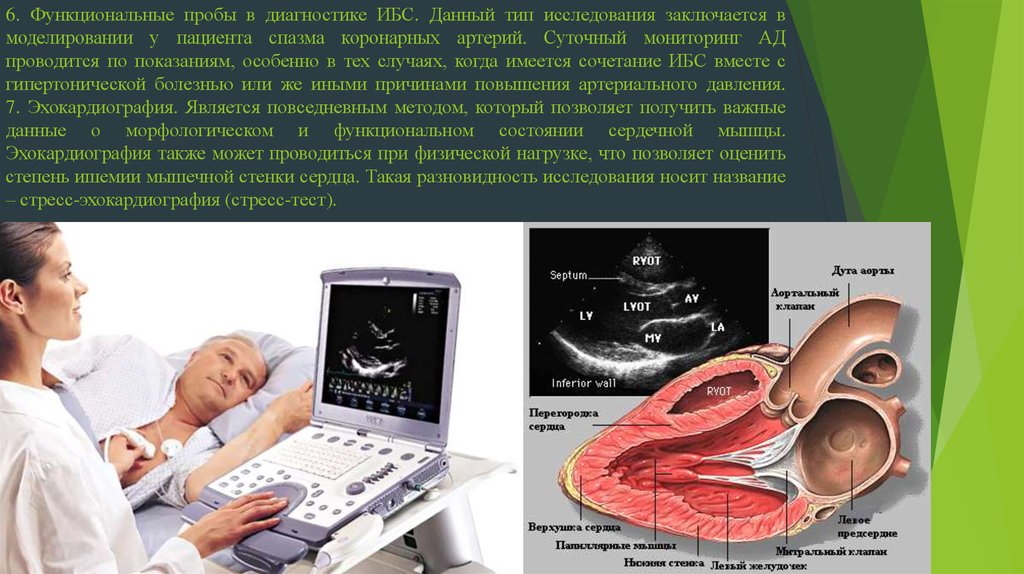 Эхо кг сердца что это. Методы исследования при ИБС. Инструментальные методы исследования ИБС. Инструментальные исследования при ИБС. Инструментальная диагностика ТБС.