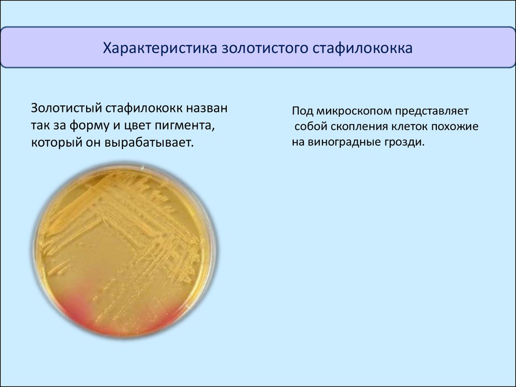 Чем лечат золотистый. Золотистый стафилококк спора. Золотистый стафилококк жизненный цикл. Золотящийся стафилококк. Золотистый стафилококк пигмент.