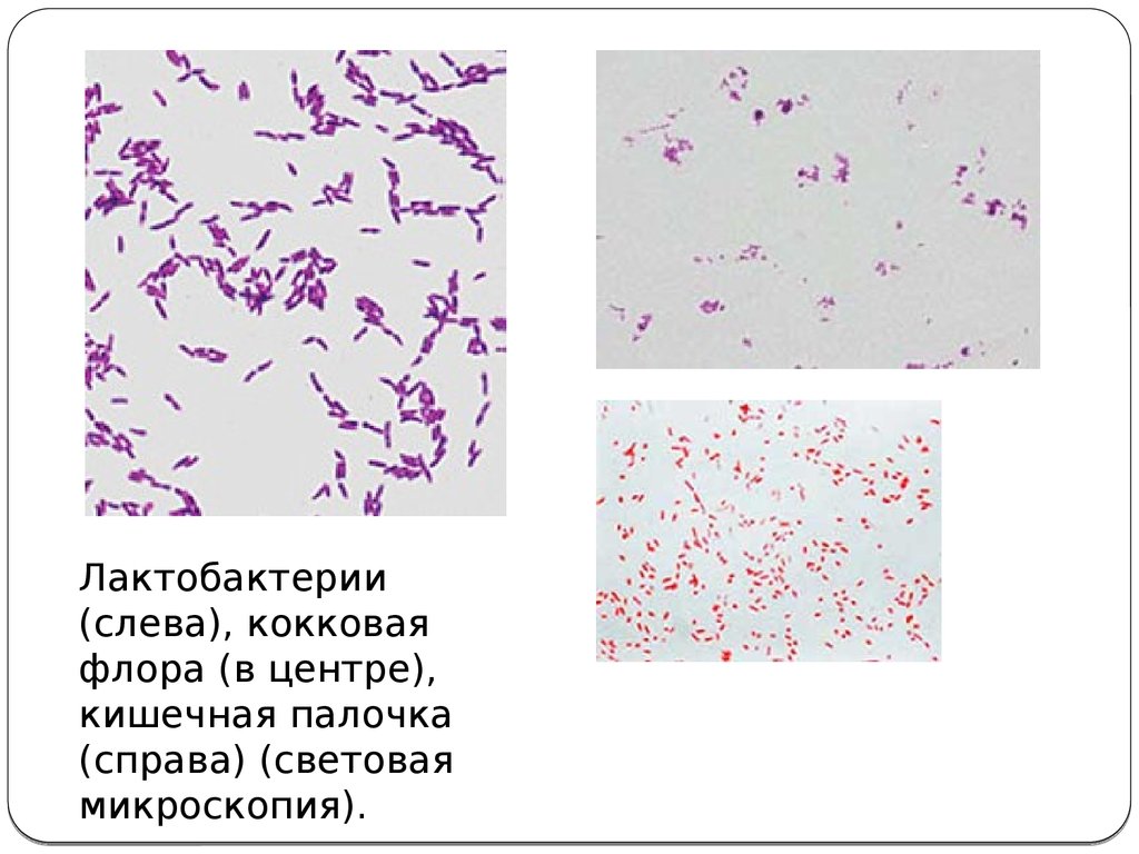 Микрофлора палочки. Палочка лактобактерии по Граму. Микроскопия кокковая Флора. Кишечная палочка световая микроскопия. Лактобактерии палочки микроскопия.