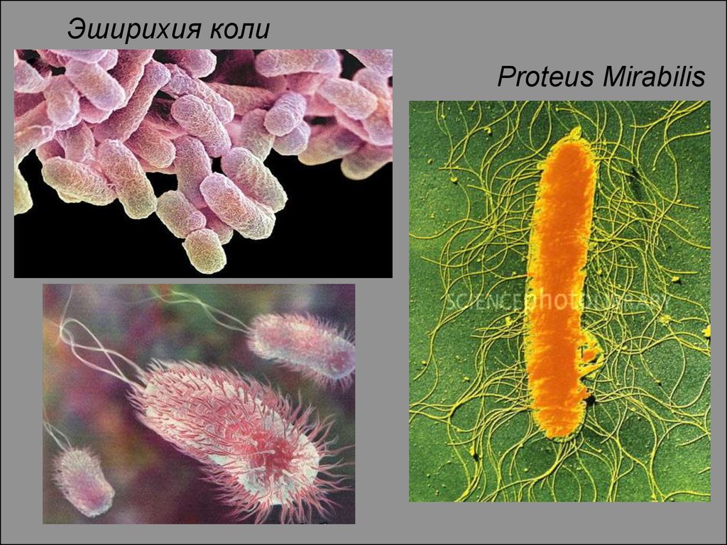 Proteus mirabilis что это такое. Proteus vulgaris бактерия. Протеус вульгарис микробиология. Протей вульгарис микробиология. Протеи бактерии микробиология.