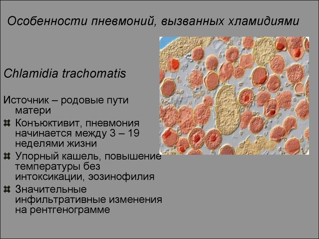 Кашель хламидии. Chlamydophila pneumoniae эпидемиология. Хламидии пневмонии.