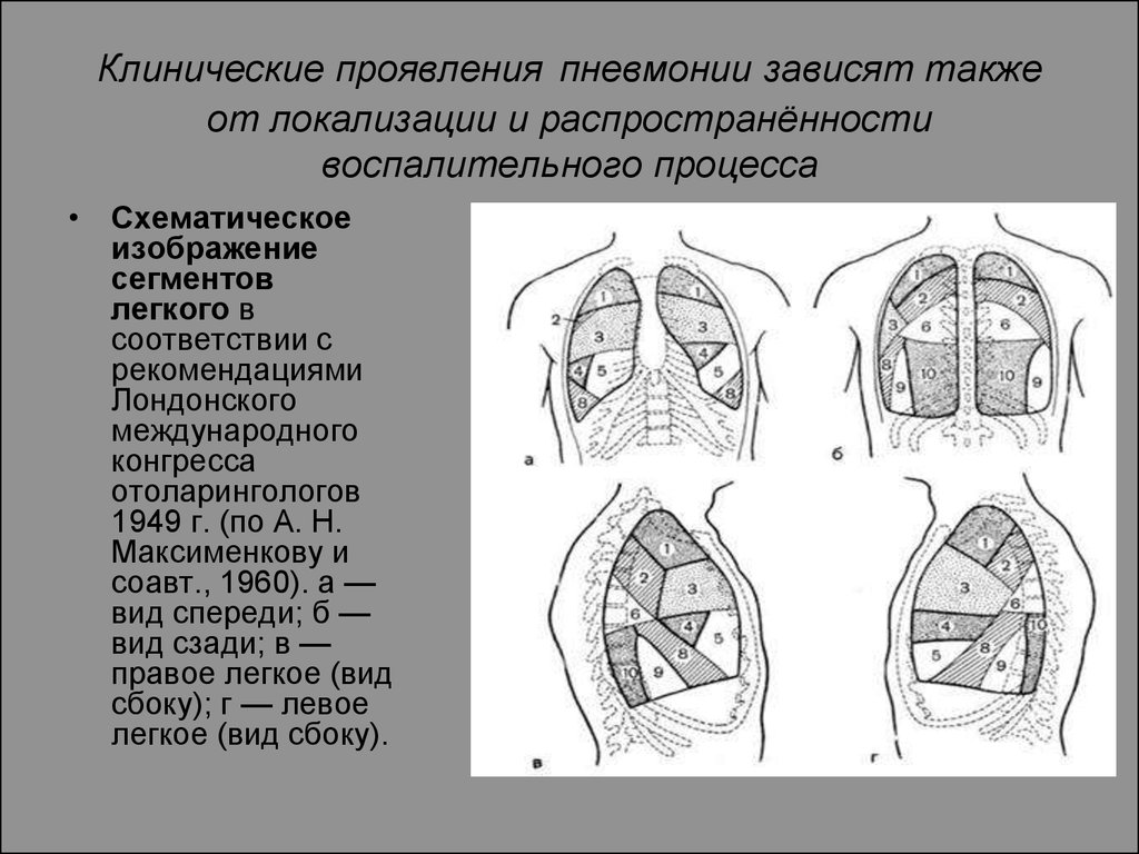 Как проявляется пневмония. Классификация пневмоний по локализации процесса. Классификация острой пневмонии по локализации. . Классификация пневмоний по локализации воспалительного процесса.. Клинические симптомы пневмонии.