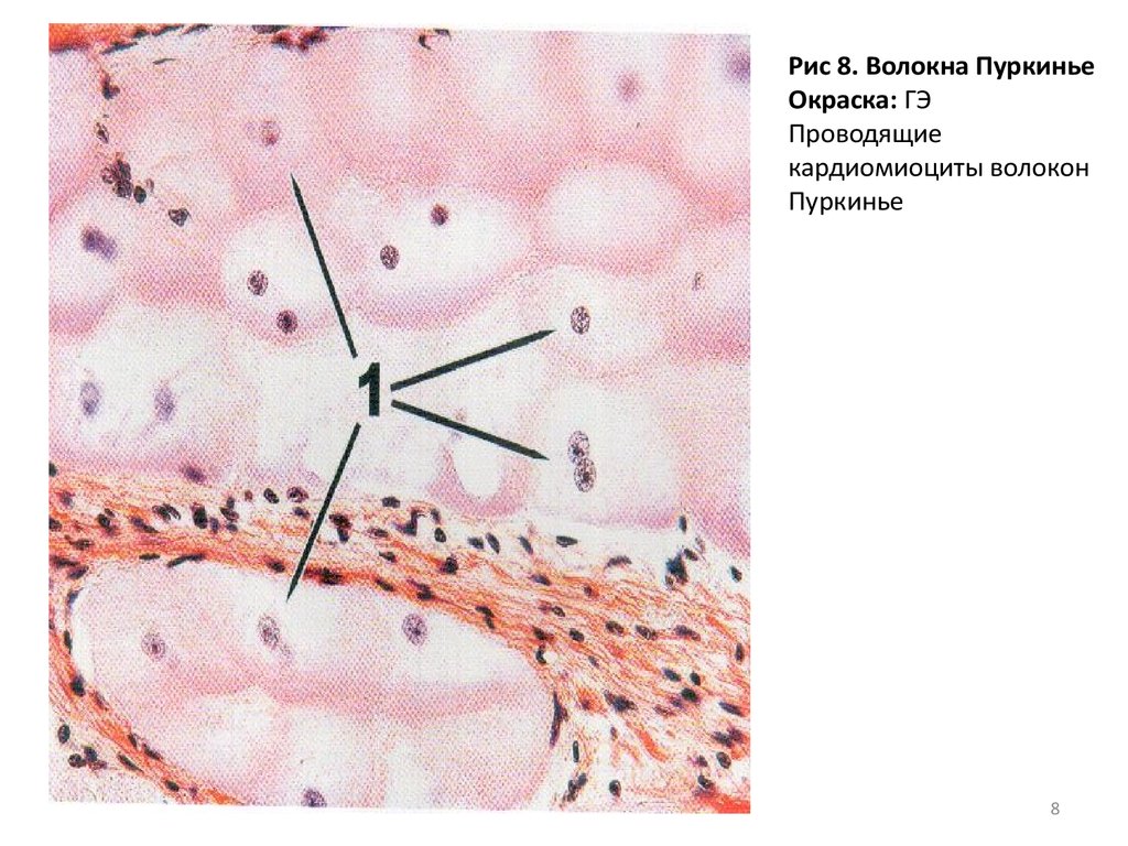 Волокна пуркинье гистология рисунок