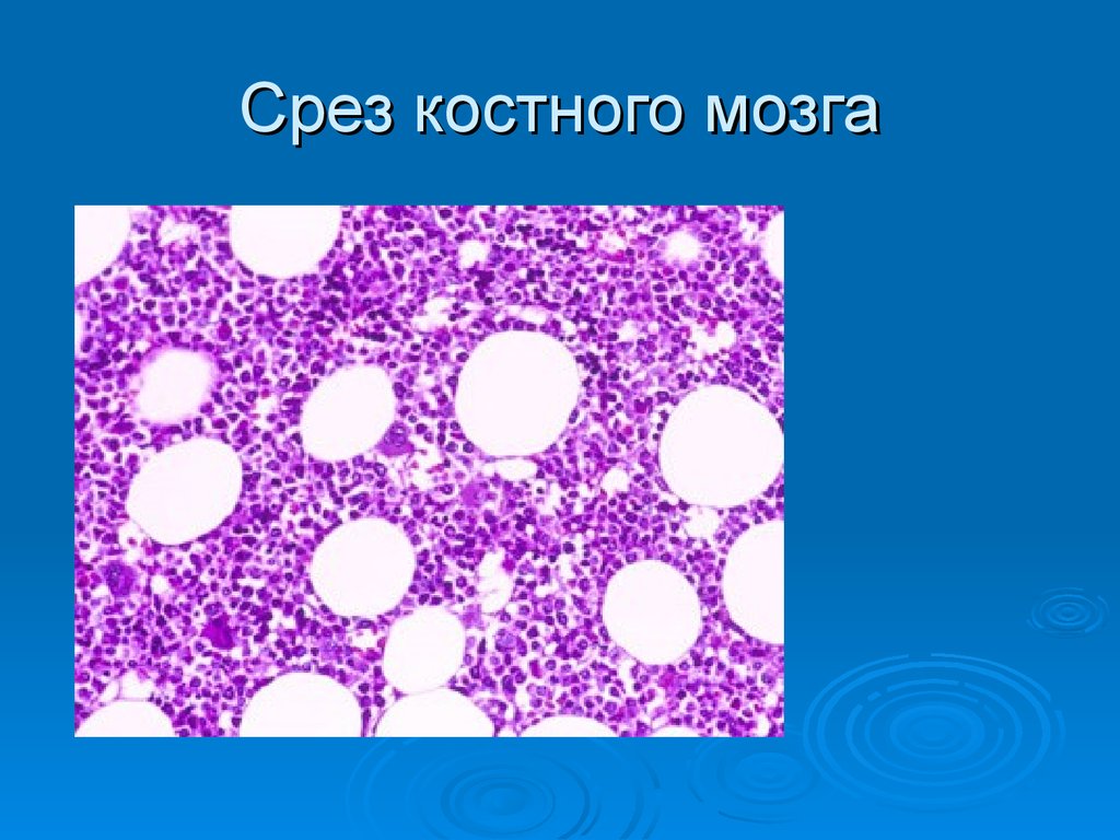 Красный мозг препарат. Срещ красный костный мозг гистология. Срез красного костного мозга гистология. Срез красного костного мозга препарат. Красный костный мозг гистология препарат.