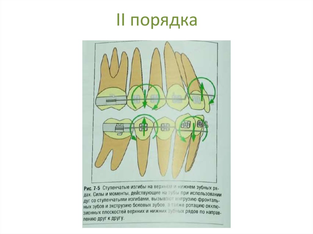 Презентация ортодонтические дуги