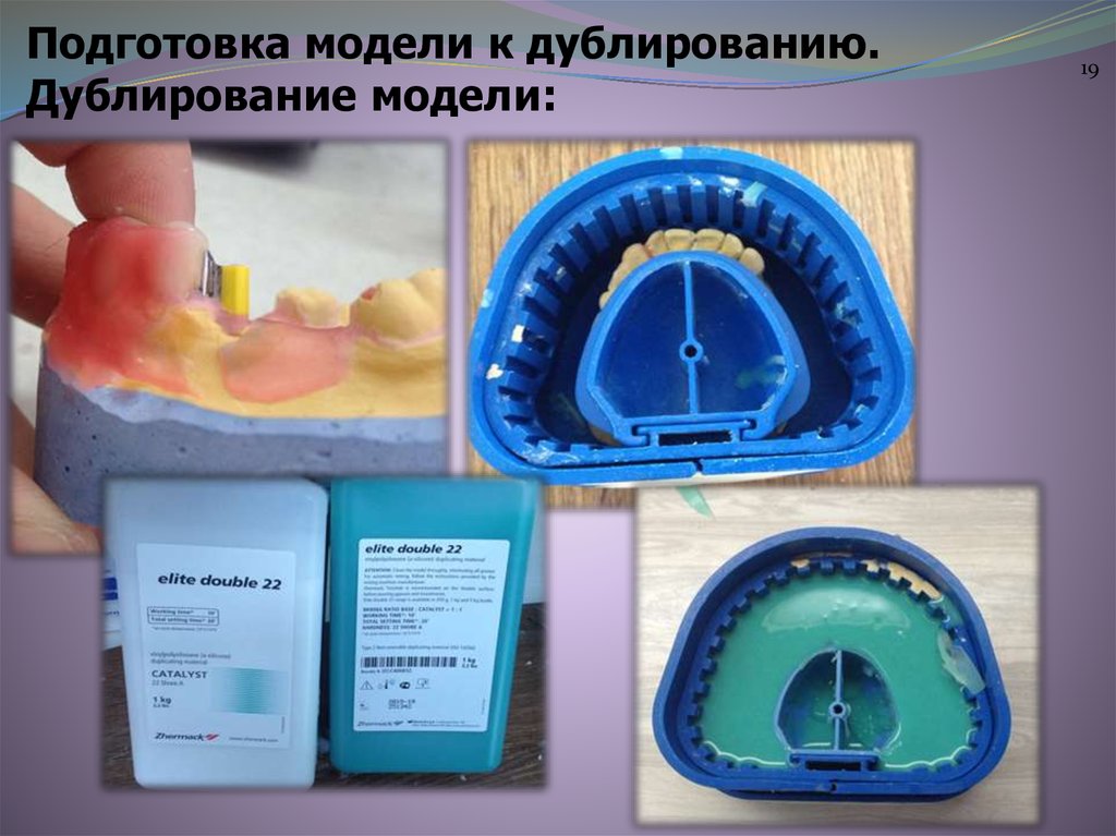 Изготовление огнеупорной модели бюгельного протеза