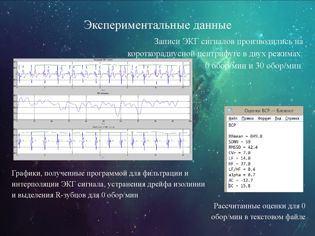 Экг сигнал. Экспериментальные данные. Данные эксперимента. Виды экспериментальных данных. Экспериментальные данные 9 класс.