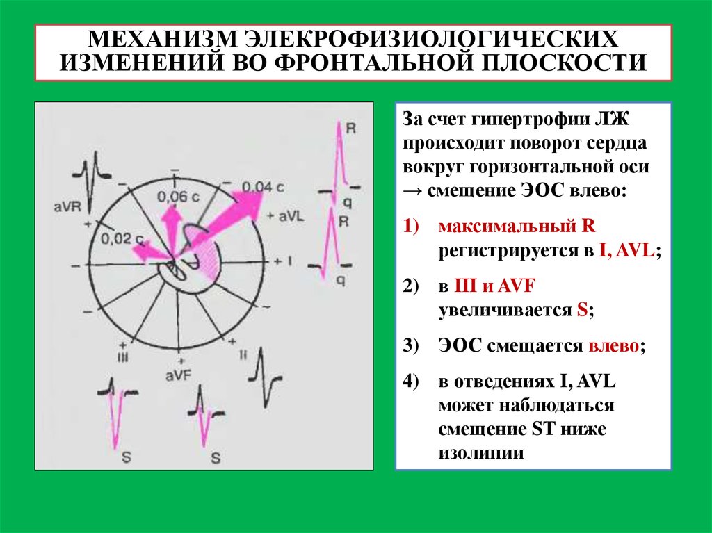 Определение осей сердца