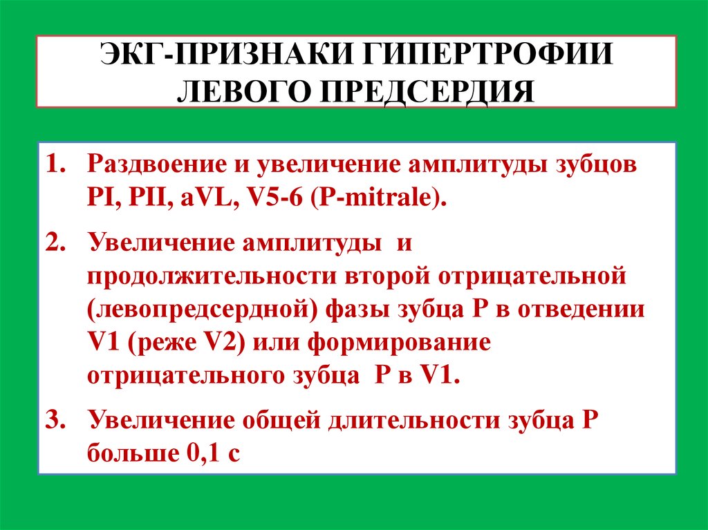 Признаки гипертрофии левого. Признаки гипертрофии левого предсердия на ЭКГ. Критерии гипертрофии левого предсердия на ЭКГ. Раздвоение зубца п на ЭКГ. Признаки гипертрофии.