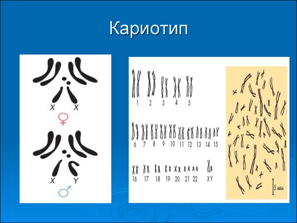 Ядро хромосомы кариотип. Кариотип. Кариотипы разных видов. Типы кариотипов. Кариотип различные.