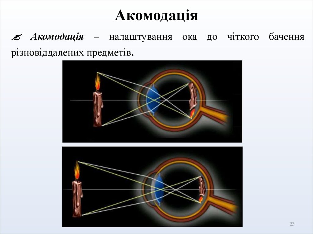 Акомодація