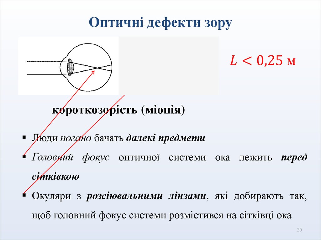 Оптичні дефекти зору