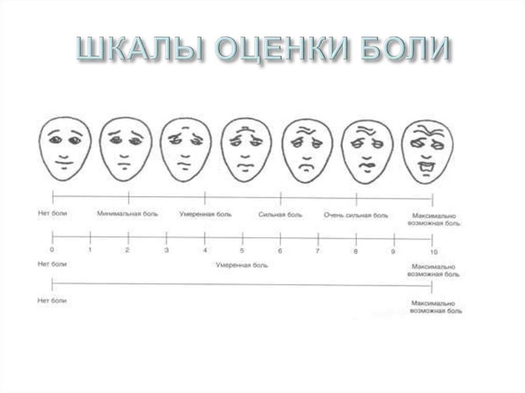 Трехступенчатая схема обезболивания