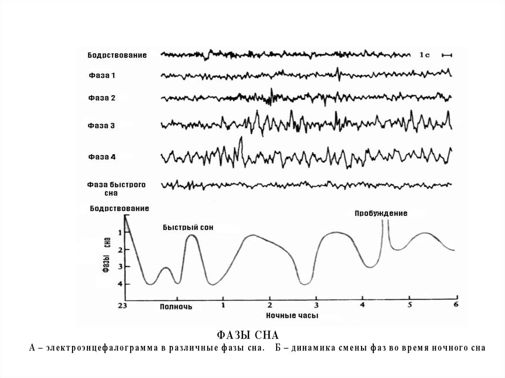 1 нарисовать схему стадий сна по данным ээг