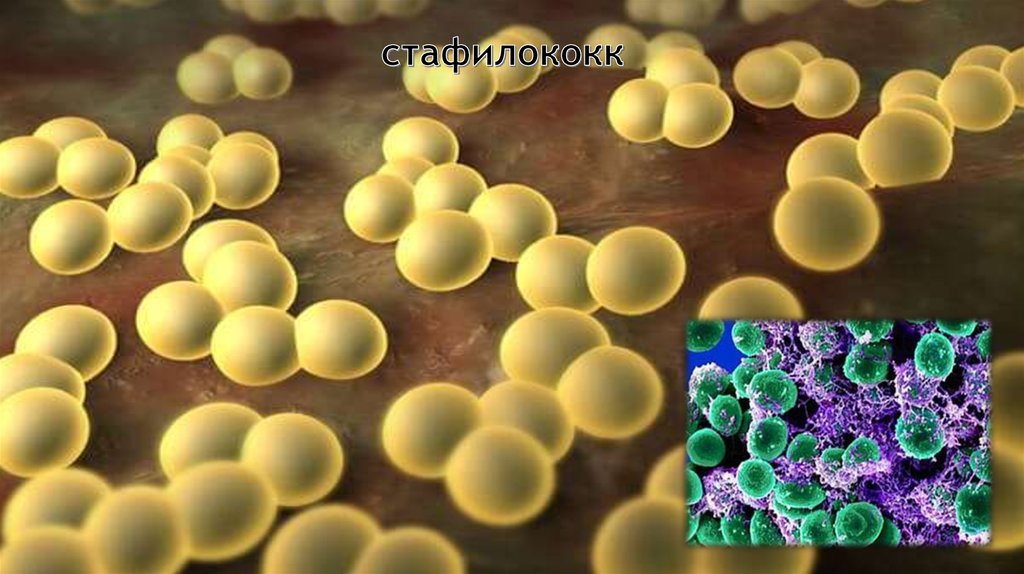 Staphylococcus aureus 5. Сапрофитный стафилококк. Стафилококк коагулазопозитивный. Золотистый стафилококк микробиология. GRSA стафилококки.