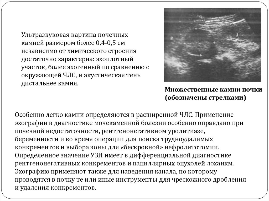 Для ультразвуковой картины почек при остром гломерулонефрите будет характерно