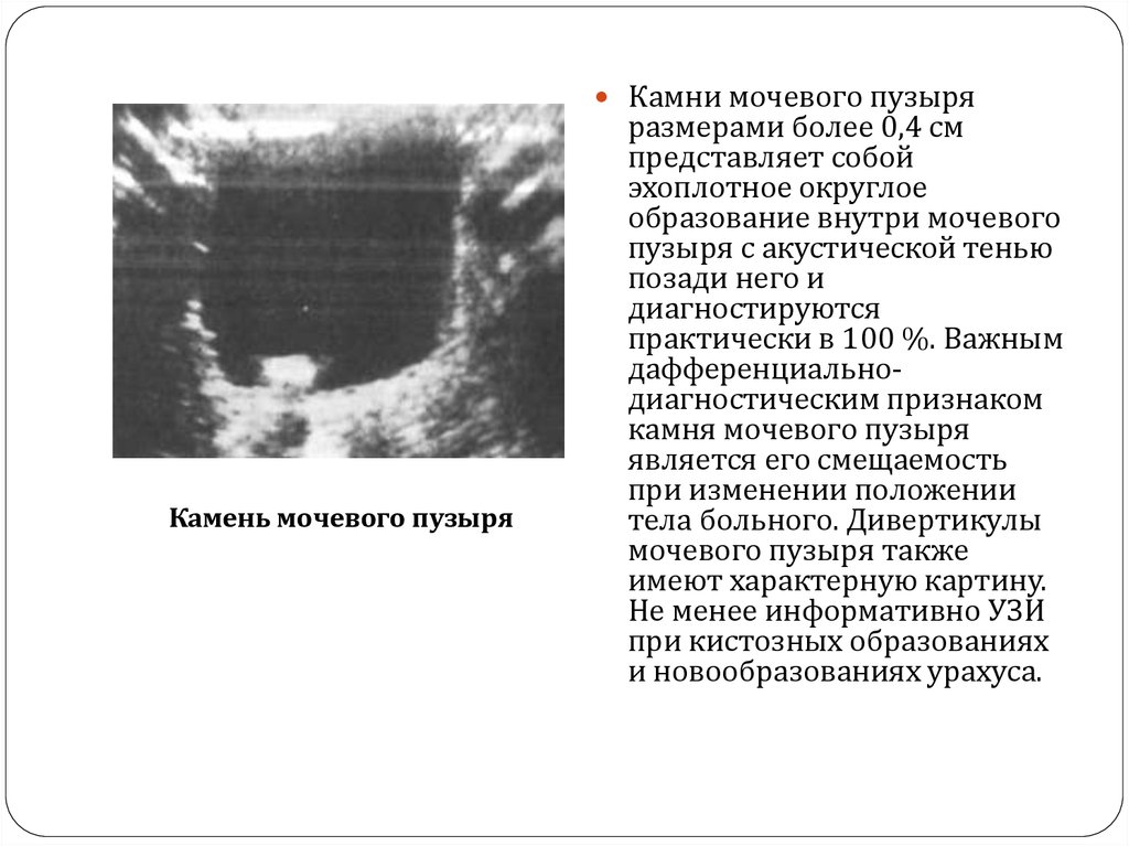 Где сделать узи почек мочевого пузыря