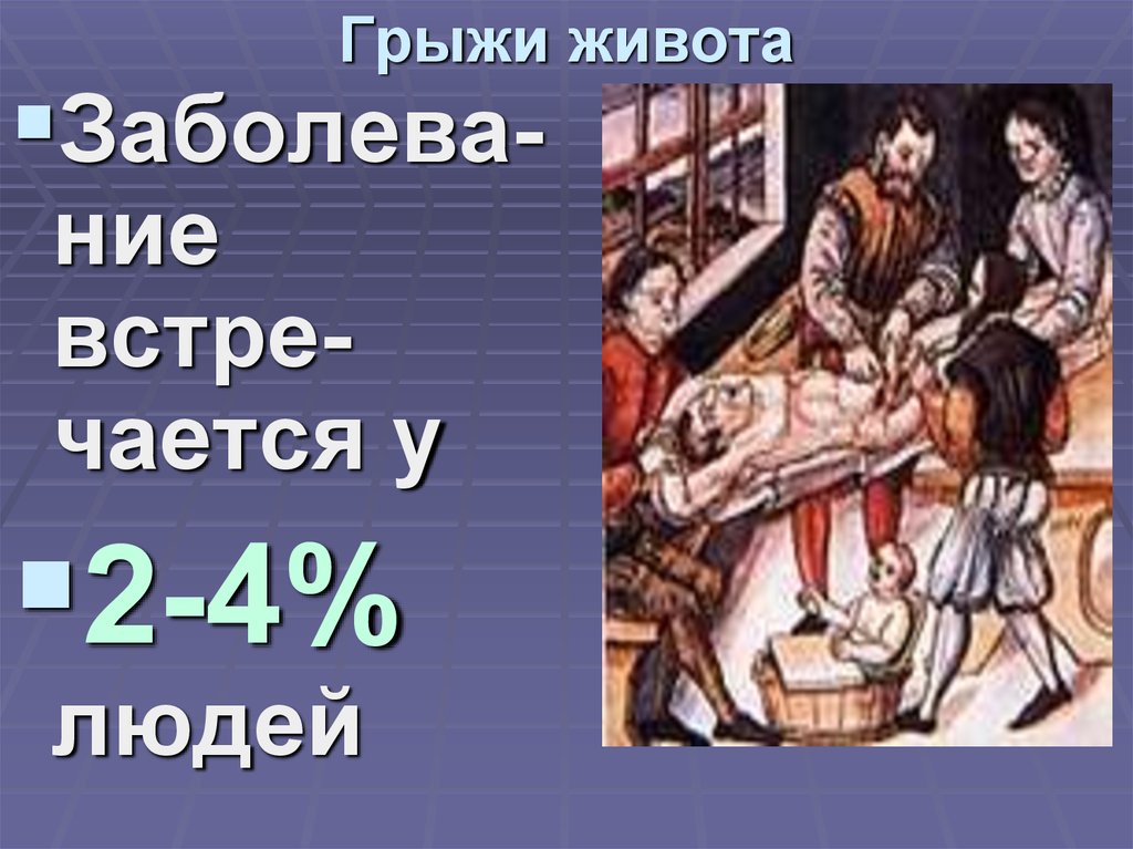 Грыжи живота