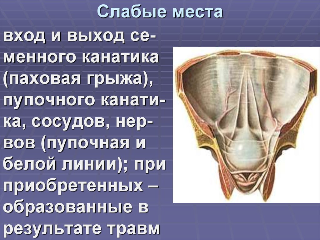 Слабые места