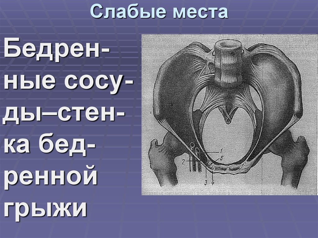 Слабые места