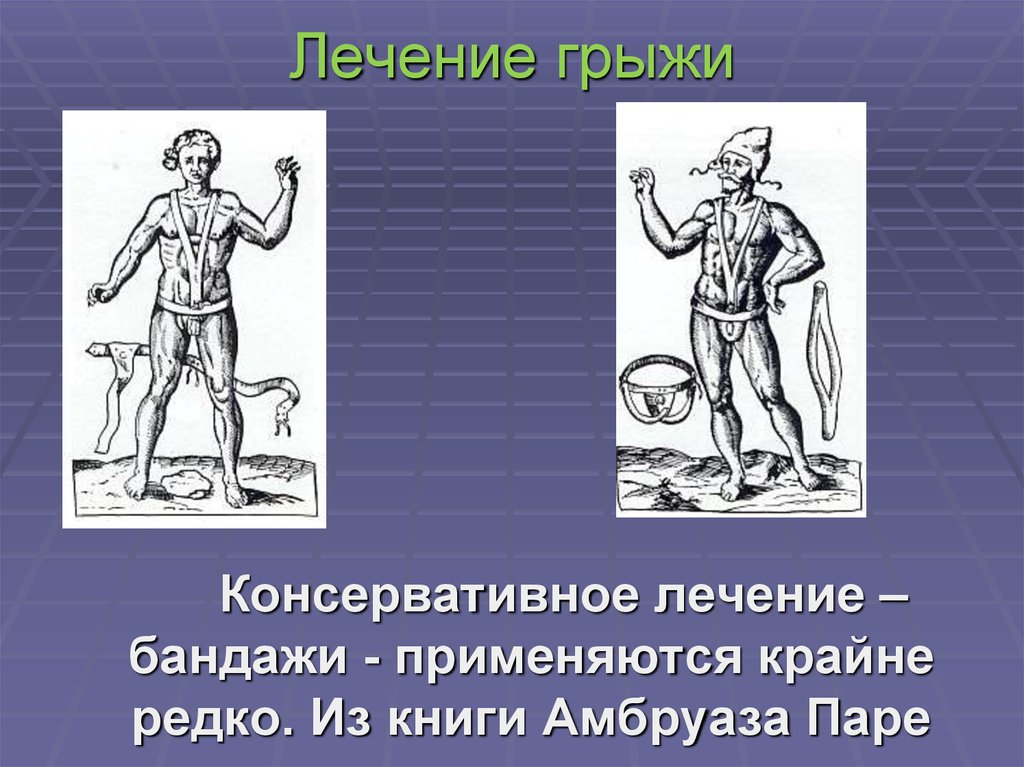 Лечение грыжи