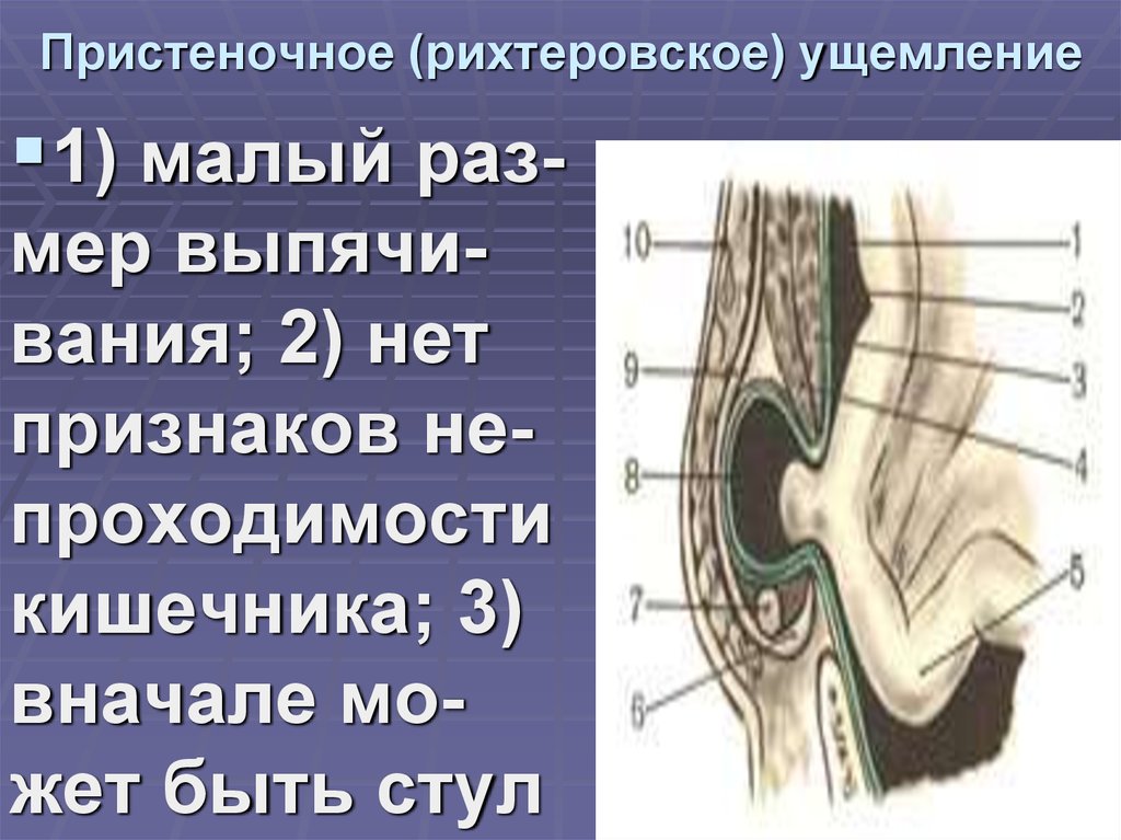 Какова клиническая картина при рихтеровском ущемлении