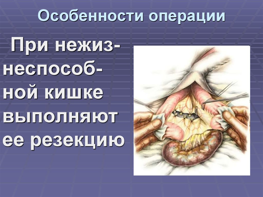 Особенности операции