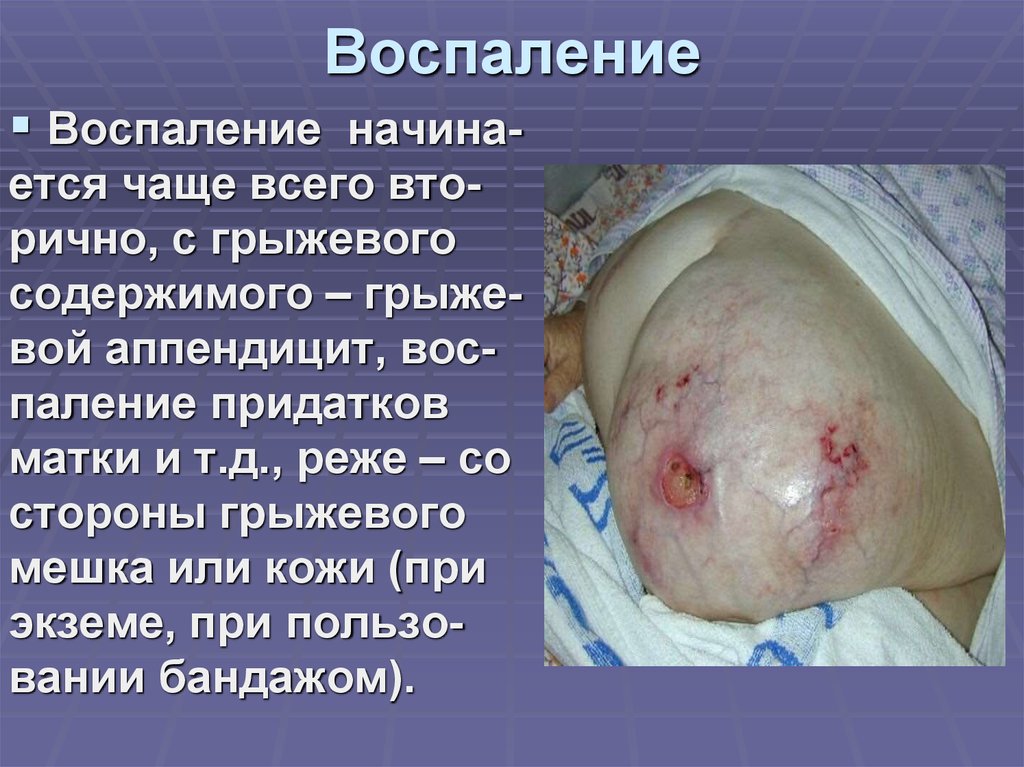 Воспаление