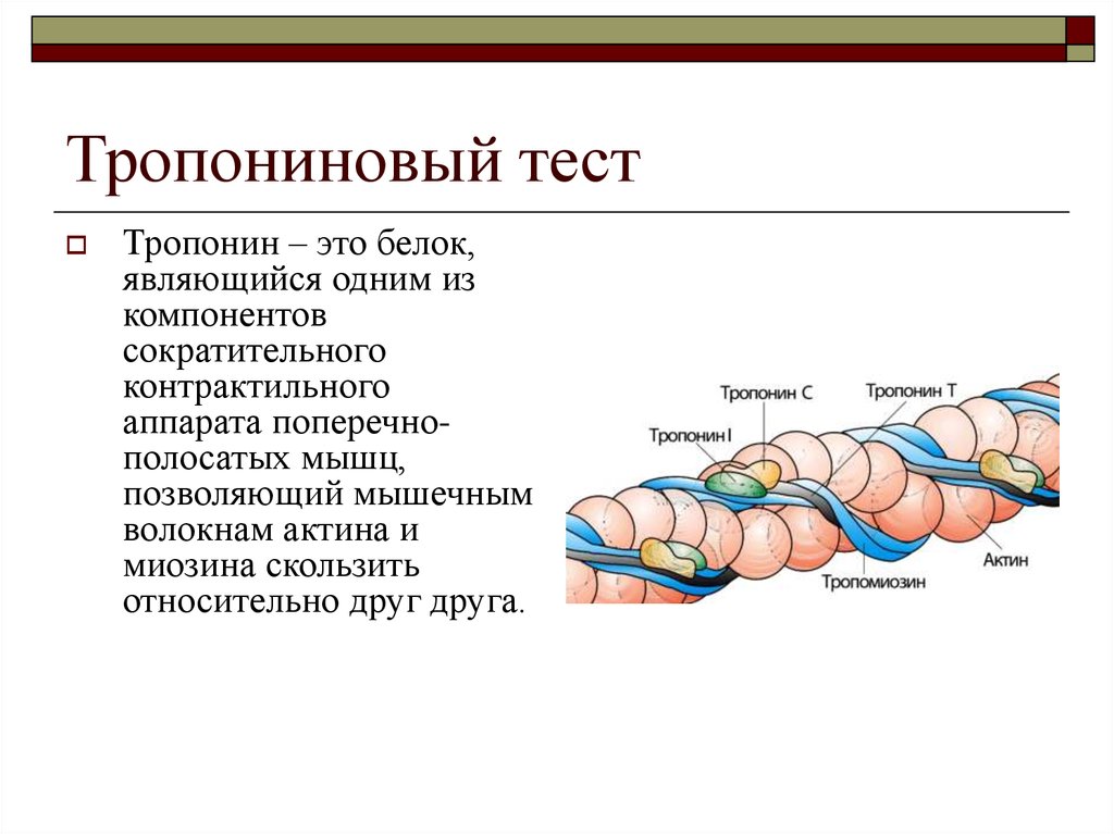 Тест тропинка. Тропонин 1 высокочувствительный. Тропониновый комплекс биохимия. Тропониновый тест показатели. Тропонин экспресс тест норма.