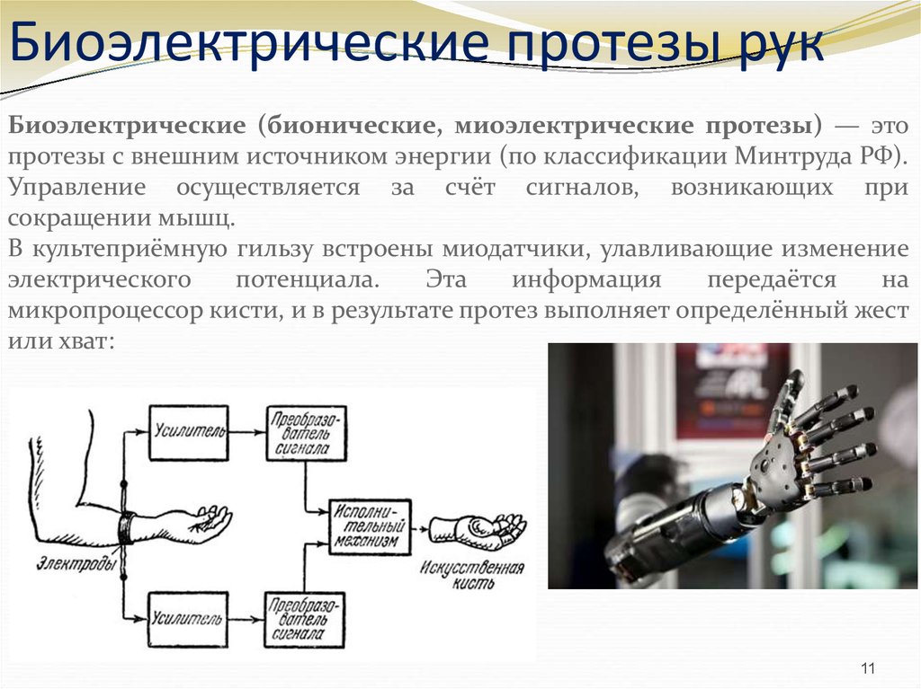 Схема бионического протеза