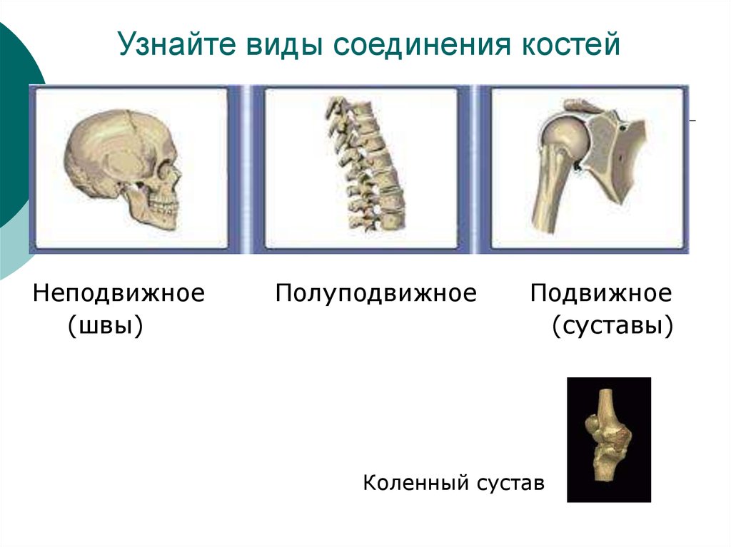 Подвижное соединение костей суставы. Типы соединения костей полуподвижные. Подвижное полуподвижное и неподвижное соединение костей. Полуподвижное соединение костей строение. Подвижные неподвижные и полуподвижные типы соединений.