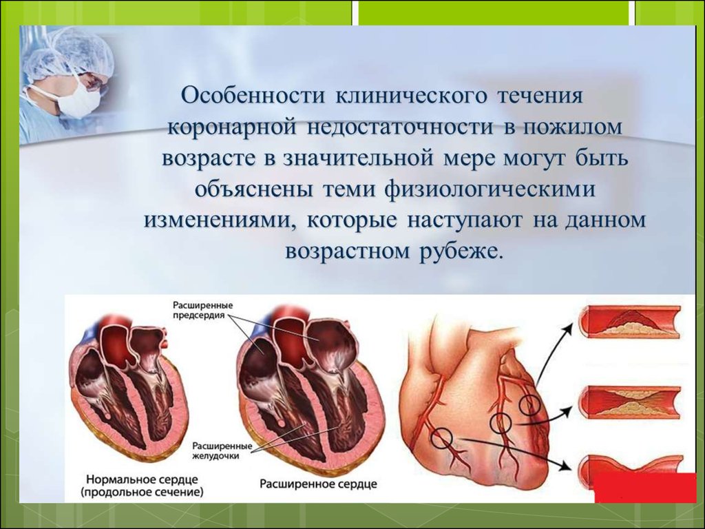 Особенности течения заболеваний в пожилом и старческом возрасте презентация