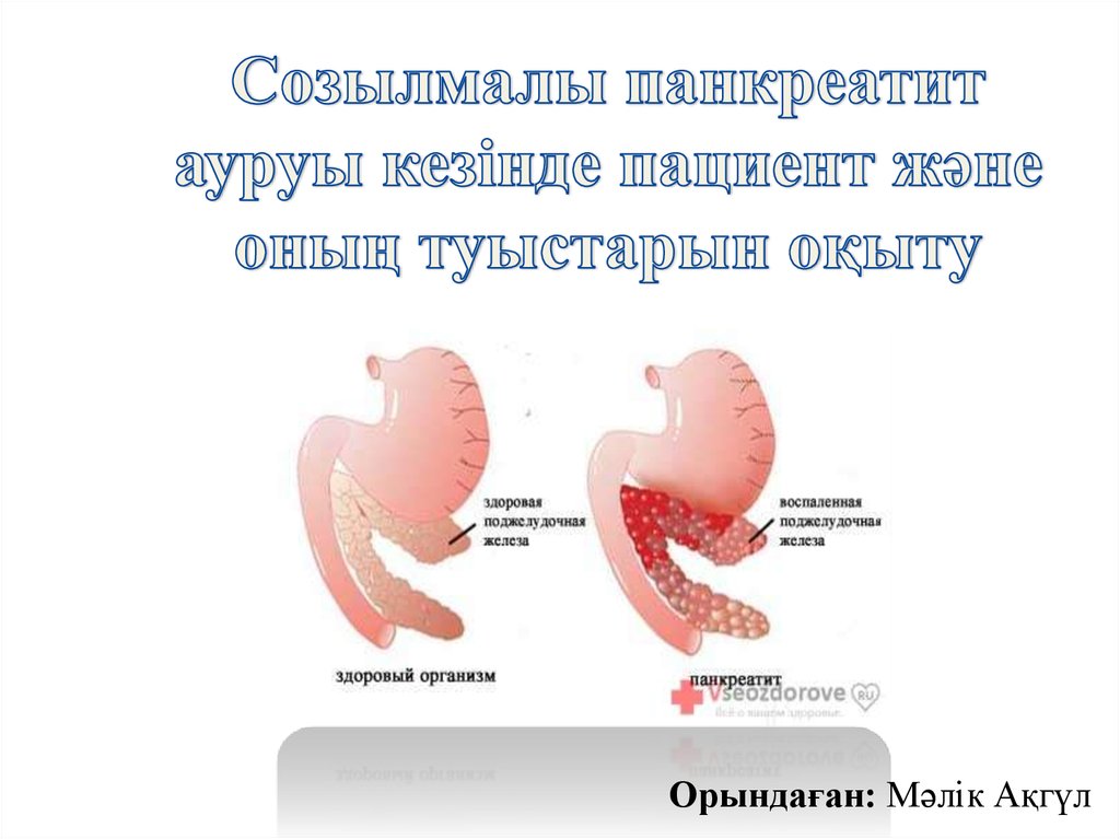 Крон ауруы презентация