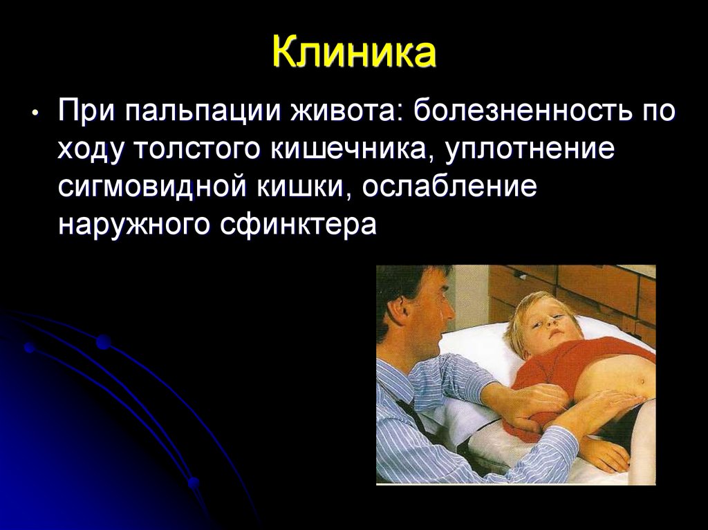 Боль по ходу кишечника. Пальпация живота при дизентерии. Болезненность при пальпации живота. Болезненность кишечника при пальпации. Боль при пальпации кишечника.