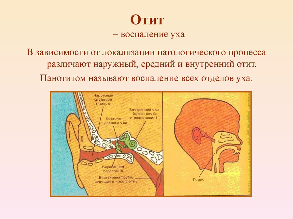 Болезнь внутреннего уха. Воспаление среднего УХЛ. Воспалениемсреднего уха. Воспаление заднего уха.