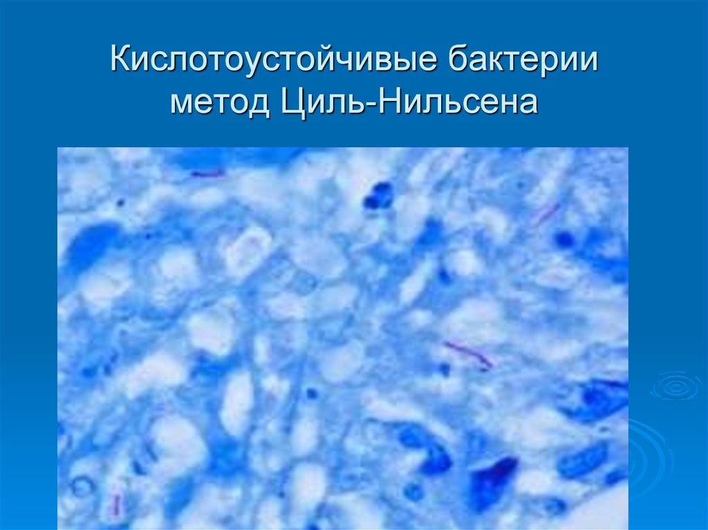 Кислотоустойчивые микобактерии. Бактерии по Цилю Нильсену. Кислотоустойчивые бактерии по Цилю Нильсену. Кислотоустойчивые микроорганизмы стафилококк. Метод окраски кислотоустойчивых бактерий по Цилю-Нильсену.