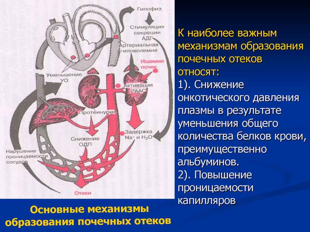 Отек почечного происхождения тест. Механизм образования почечных отеков. Механизм возникновения почечных отеков. Механизмы отеков почки. Механизм почесных отёков.