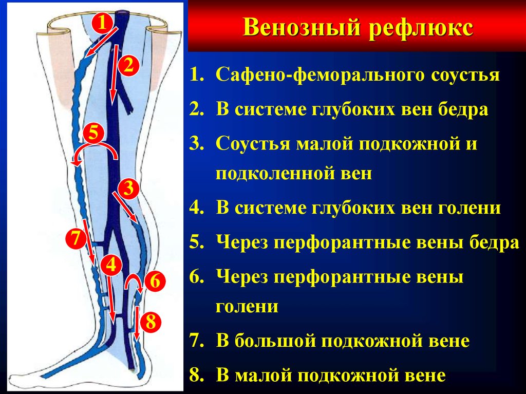 Перфорантные вены нижних конечностей это