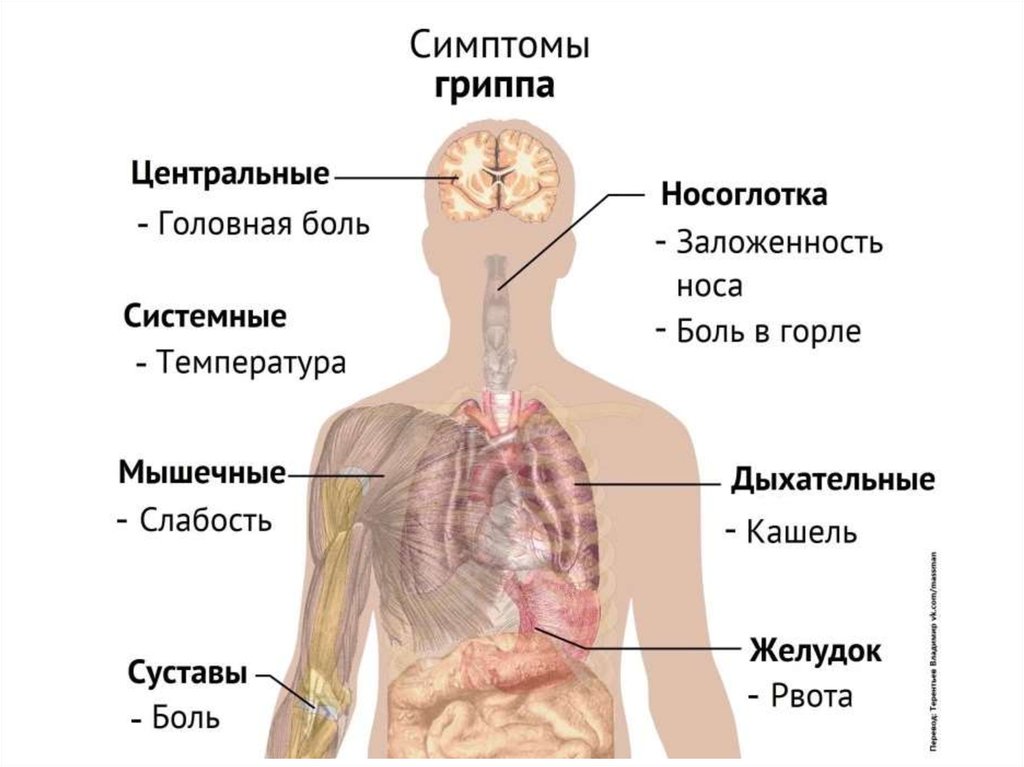 Грипп признаки. Клинические симптомы гриппа. Основной симптом гриппа. Основные симптомы гриппа. Грипп клиника.