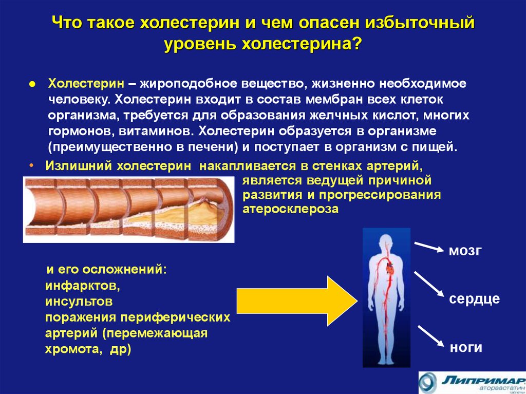 Почему много холестерина