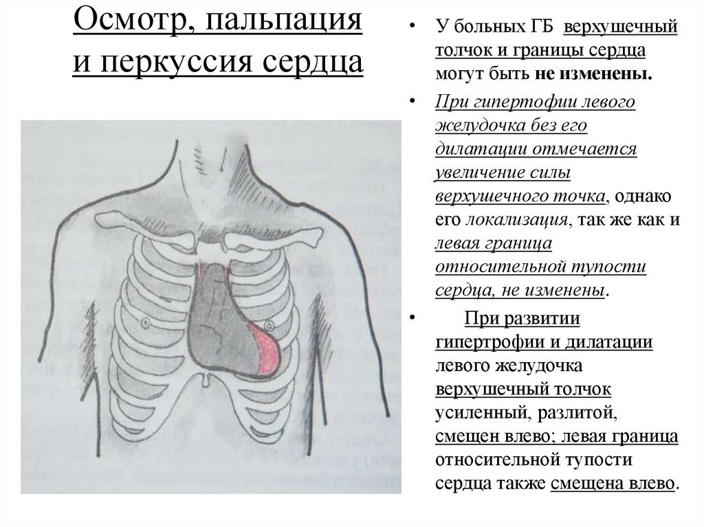 Осмотр перкуссия. Пальпация перкуссия аускультация сердца. Гипертоническая болезнь осмотр пальпация перкуссия. Перкуссия сердца и аускультация сердца. Перкуссия сердца пропедевтика границы.