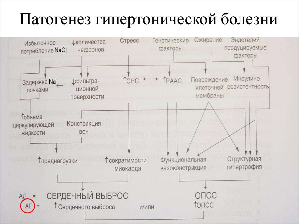 Схема заболеваний. Патогенез артериальной гипертензии схема. Схема патогенеза первичной артериальной гипертензии. Патогенез гипертонии схема. Механизм развития гипертонической болезни.