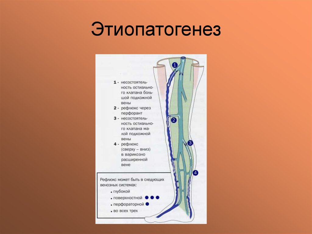 Перфорантные вены нижних конечностей это