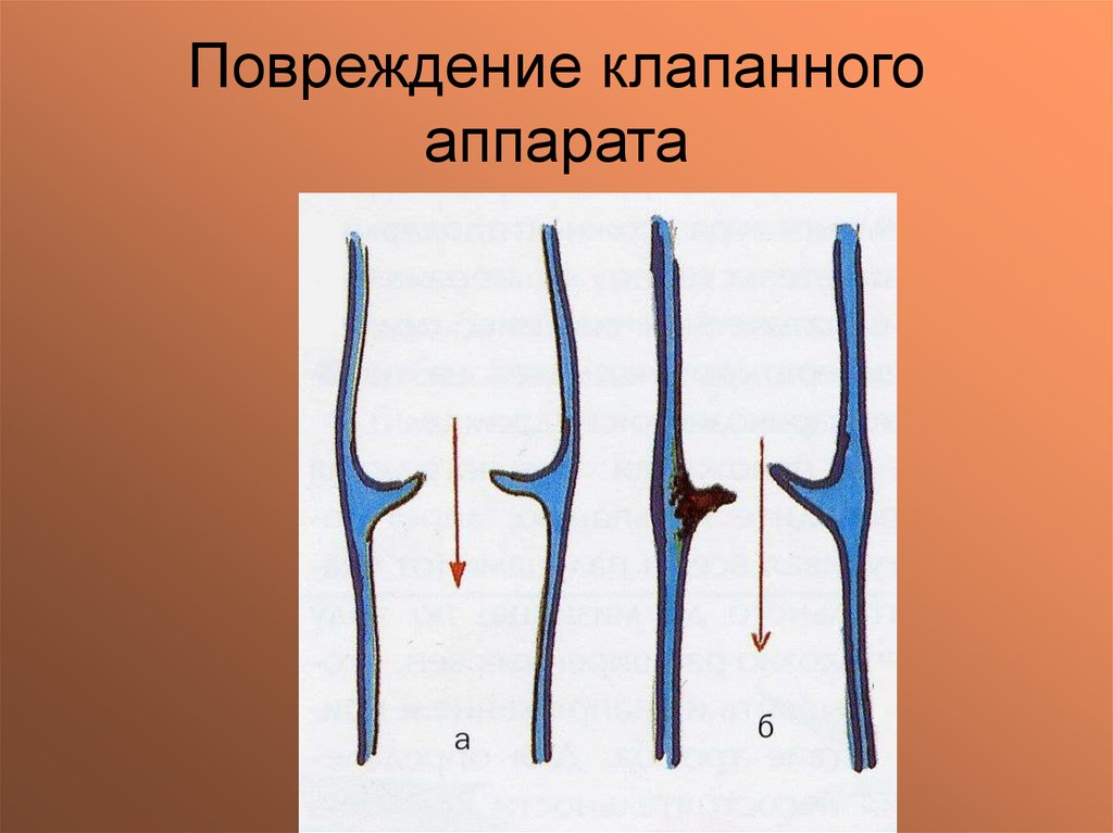 сотрясение головного мозга мкб код 10. повреждение 6. падение дерева на палатку. повреждение 6. взрывы в аэропорту под минском.